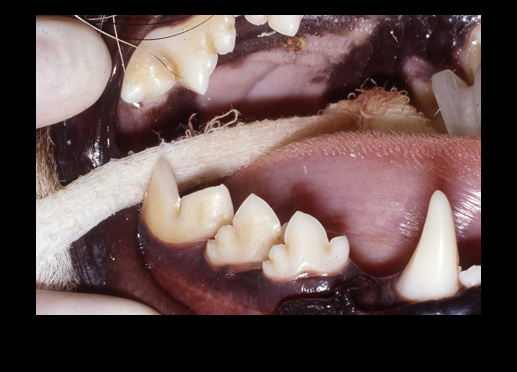 side view human teeth